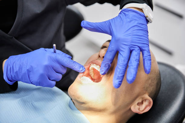 Best Emergency Treatment for Dental Infections or Abscesses in Ellenville, NY